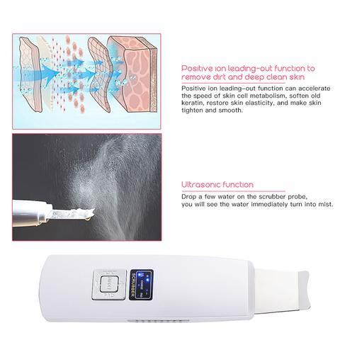 Ultrasonic Skin Scrubber – Facial Cleanser & Blackhead Remover with Vibration Massage (Ultrasound Peeling)