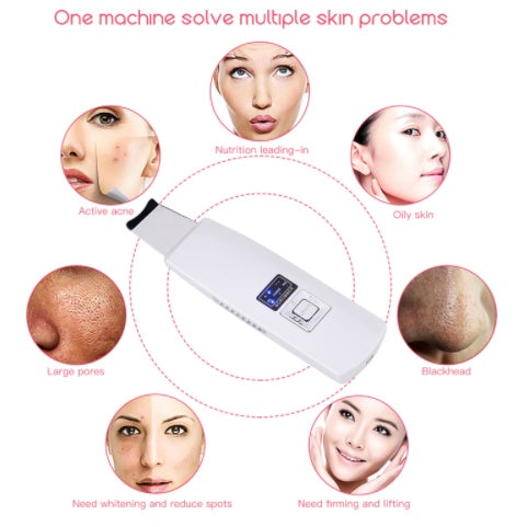 Ultrasonic Skin Scrubber – Facial Cleanser & Blackhead Remover with Vibration Massage (Ultrasound Peeling)